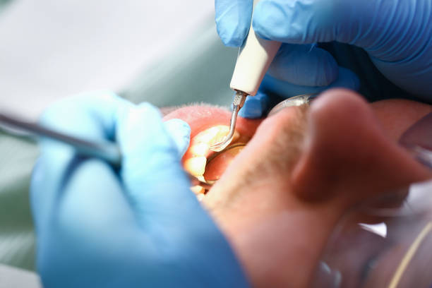 Best Emergency Treatment for Toothache in Ellington, MO