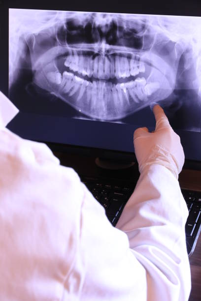 Best Emergency Broken Tooth Repair in Ellington, MO
