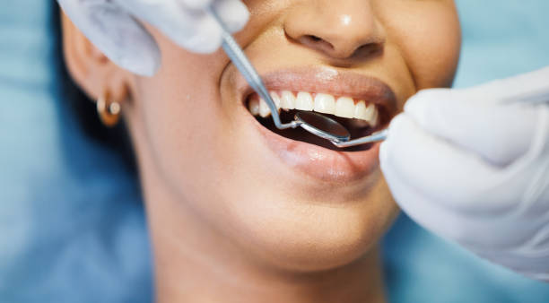 Best Weekend Emergency Dentist in Ellington, MO